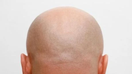 All Hype? BALD Meme Coin’s Volume Shaved By 96%
